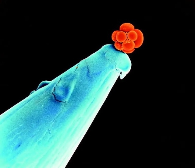 An Early Human Embryo On The Tip Of A Needle