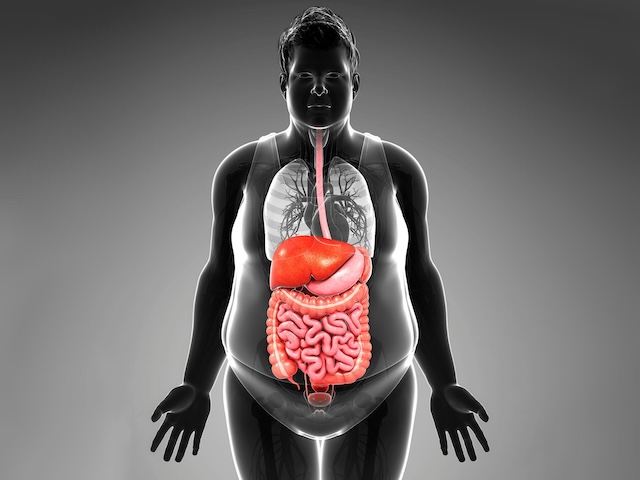 A visualization of the growing issue—how our internal systems struggle under the strain of modern diets and inactivity, leading to widespread obesity.