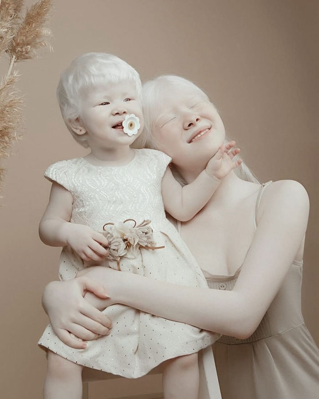 A heartwarming photo of a young albino girl with her little sister, exuding joy and innocence