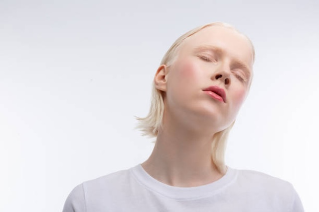 A serene and minimalist portrait, emphasizing the soft features and ethereal beauty of albinism