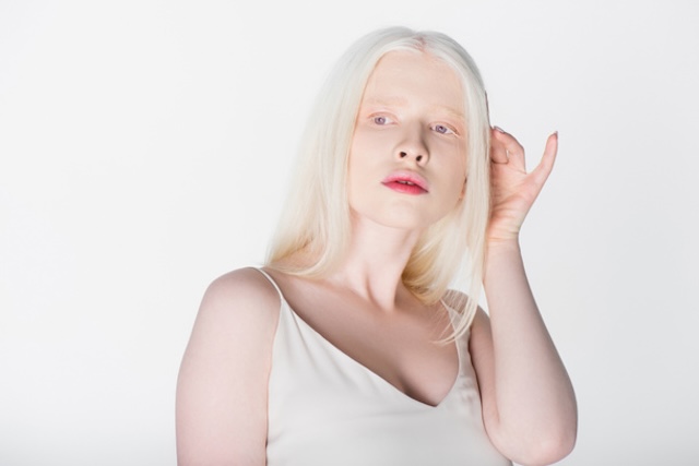 A delicate expression of beauty, this young woman’s albinism radiates through her porcelain skin and light features