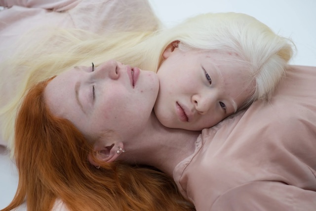 A symbolic image of connection and difference, with two individuals lying side by side, showcasing the contrast between red and platinum blonde hair