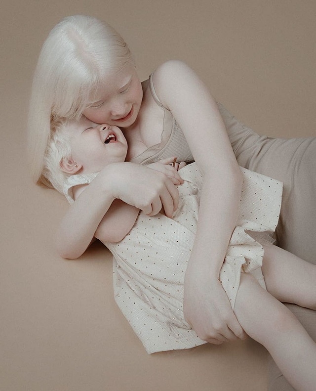 A tender, intimate moment between an albino sisters, illustrating their close bond and shared beauty in a soft, beige-toned setting