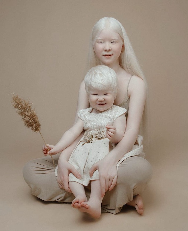 A captivating portrait of an albino sisters, dressed in neutral tones, exuding calmness and serenity