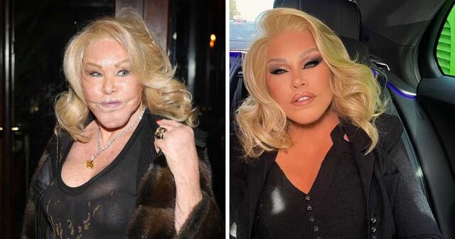 Jocelyn Wildenstein, Renowned for Her Distinctive Cat-Like Features, Claims She Has Never Had Plastic Surgery.