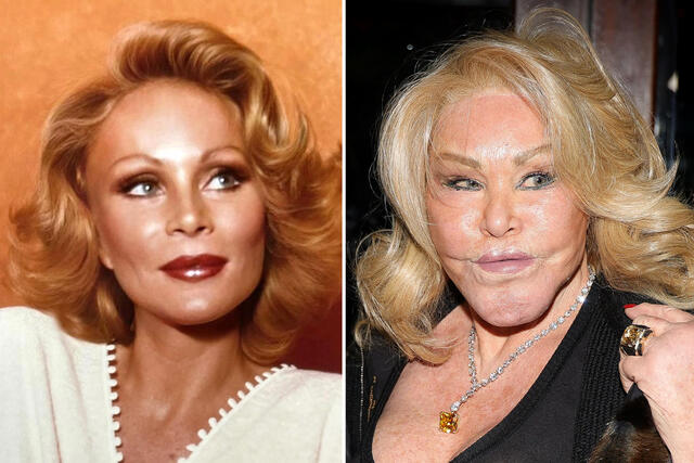 Jocelyn Wildenstein 