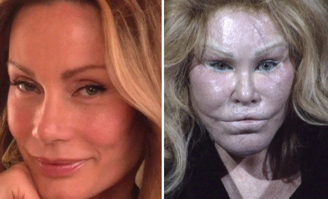 Joselyn Wildenstein: The Controversial Transformation Behind the “Catwoman” Legend