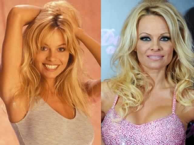 Pamela Anderson 