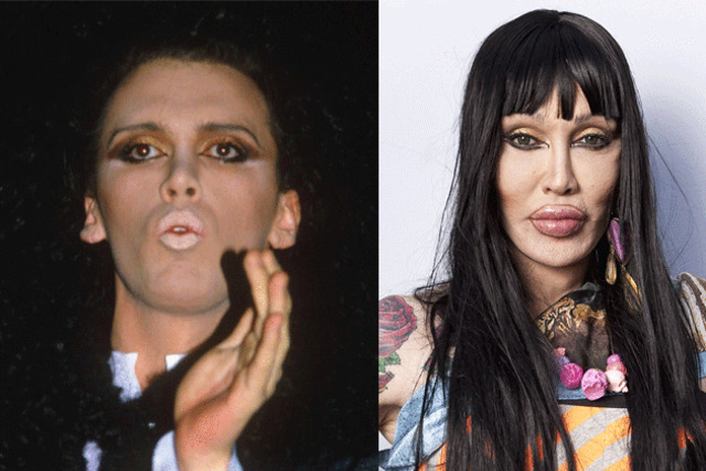 Pete Burns 