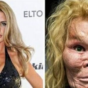 The Price of Fame: Famous Celebrities Who Spent Millions Transforming Their Appearance