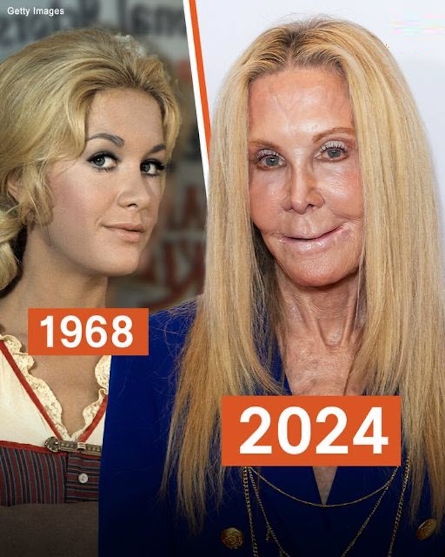 A glimpse of the former Knots Landing star in 1968, contrasting her look in 2024 — did cosmetic procedures play a role?