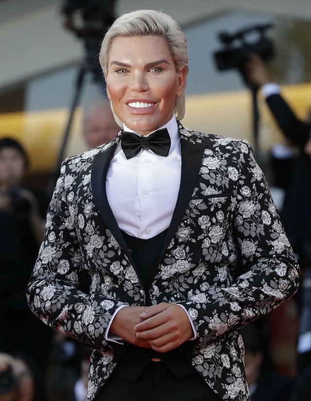 Rodrigo Alves, dressed in a floral-patterned tuxedo, attends another glamorous event with a distinctive style, showcasing his plastic surgery journey