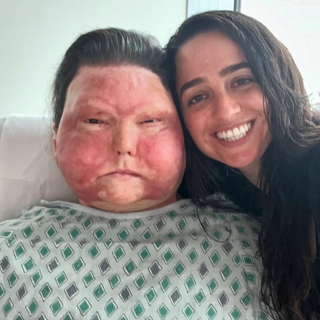 Joe DiMeo smiles alongside his partner as they take a sweet selfie during his journey to recovery after undergoing face and hand transplants