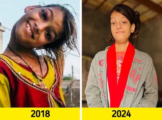 After years of pain, Afsheen is now living a life full of hope and promise thanks to a brave doctor and groundbreaking surgery