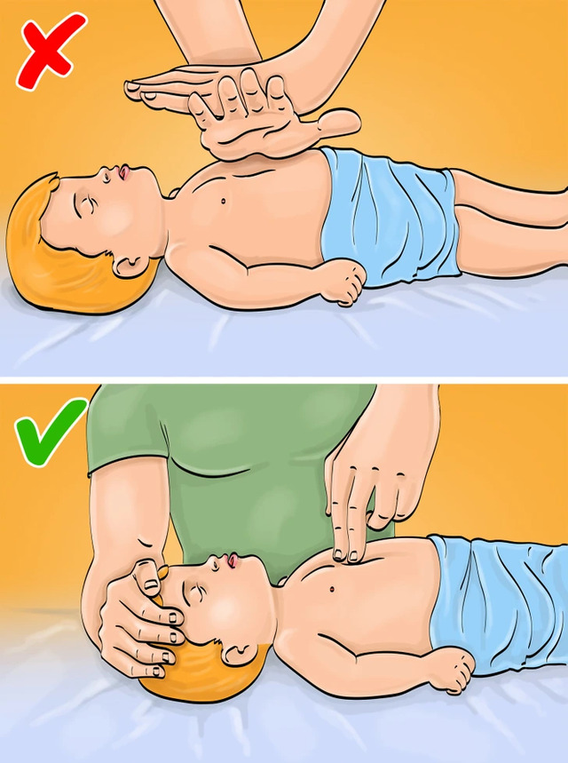 Cardiac Arrest: Tailor CPR to the Patient’s Age