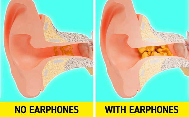 Frequent use of earbuds can disrupt the natural process of earwax removal.