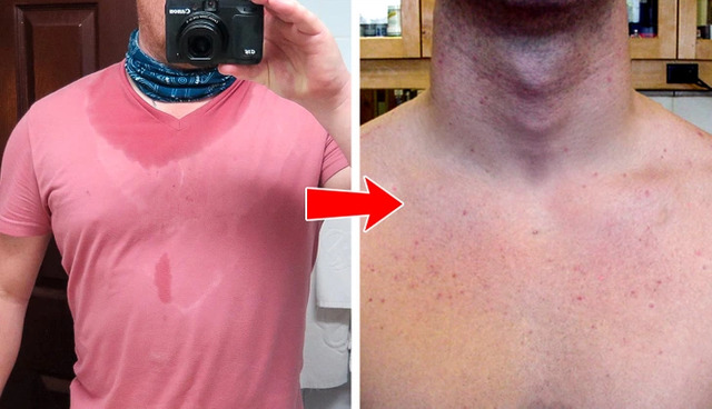 On the Chest: Sensitive Skin and Tight Clothing