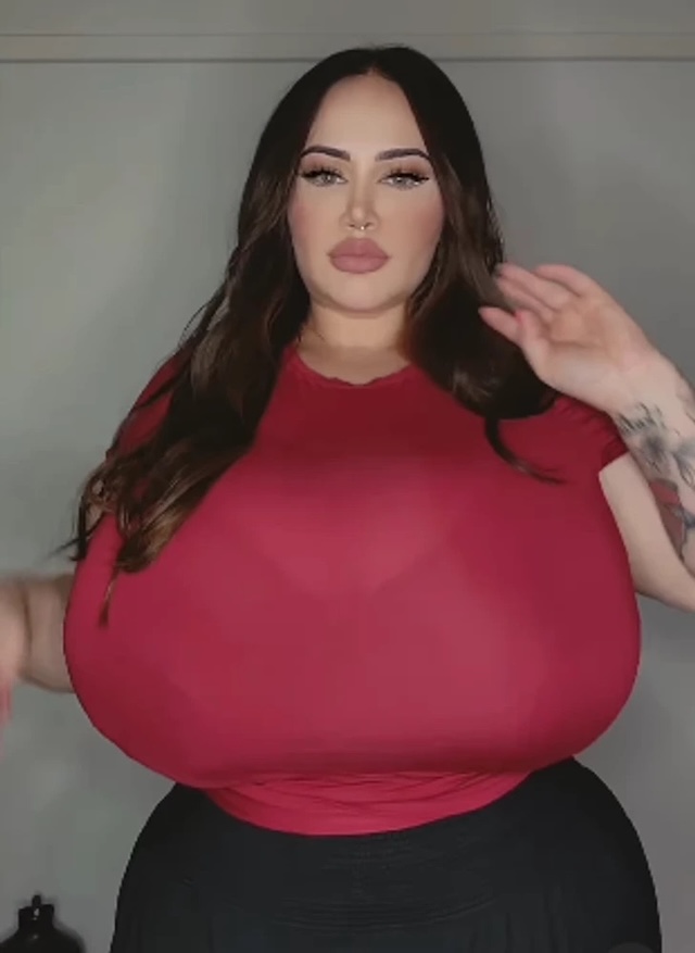 29-year-old Paige Amelia from Melbourne, Australia, suffers from gigantomastia, a condition causing uncontrolled breast growth