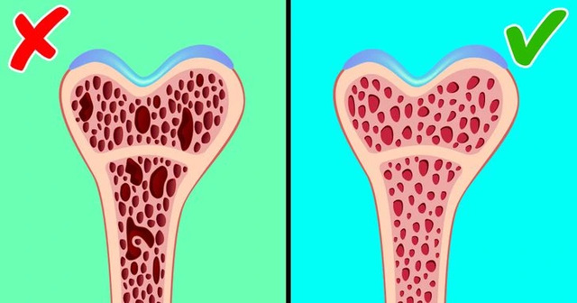 Astronauts can lose about 1% of their bone mass per month in space, a rate much higher than what is seen in elderly people on Earth who suffer from osteoporosis