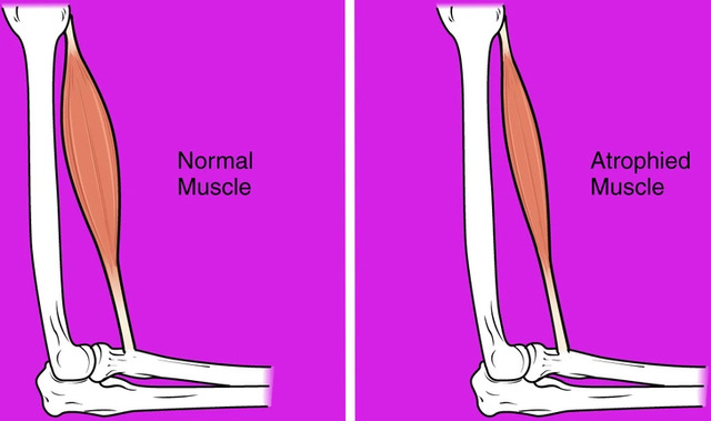 Without regular exercise, astronauts can lose up to 20% of their muscle mass in just a few days.