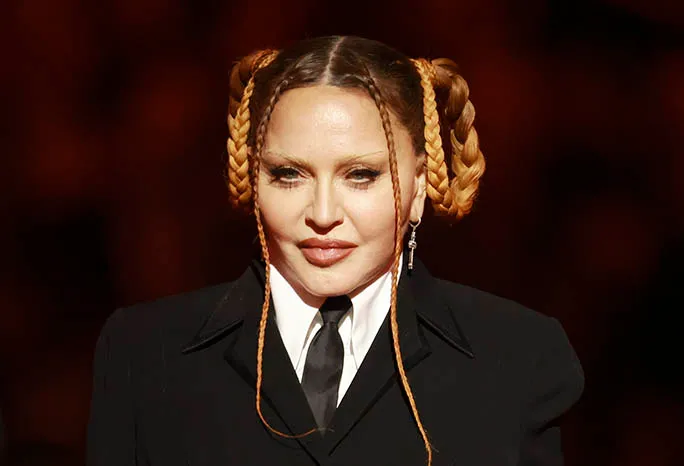 Back then, her fuller cheeks and lips led many to call her “unrecognizable.