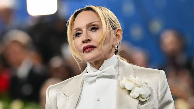 One of the most talked-about changes was her smile — Madonna’s iconic tooth gap was no longer visible.