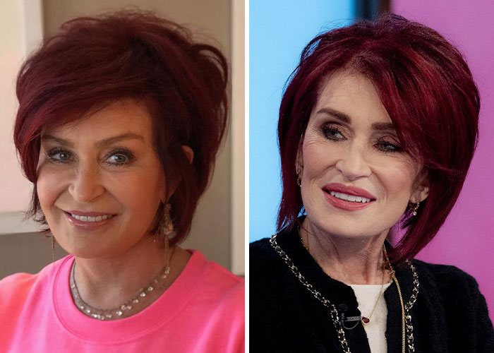 Sharon Osbourne: A Fresh Facelift and the Journey to Embrace Natural Aging