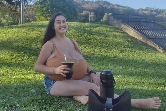 Thaynara Marconde lives with gigantomastia, a rare medical condition that caused her breasts to grow to an overwhelming 22 pounds