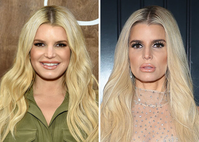 Dry skin, sunken eyes and wrinkles: the effects of Ozempic in Jessica Simpson