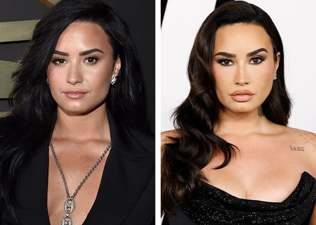 Demi Lovato embraces transparency, openly discussing her anti-wrinkle treatments.