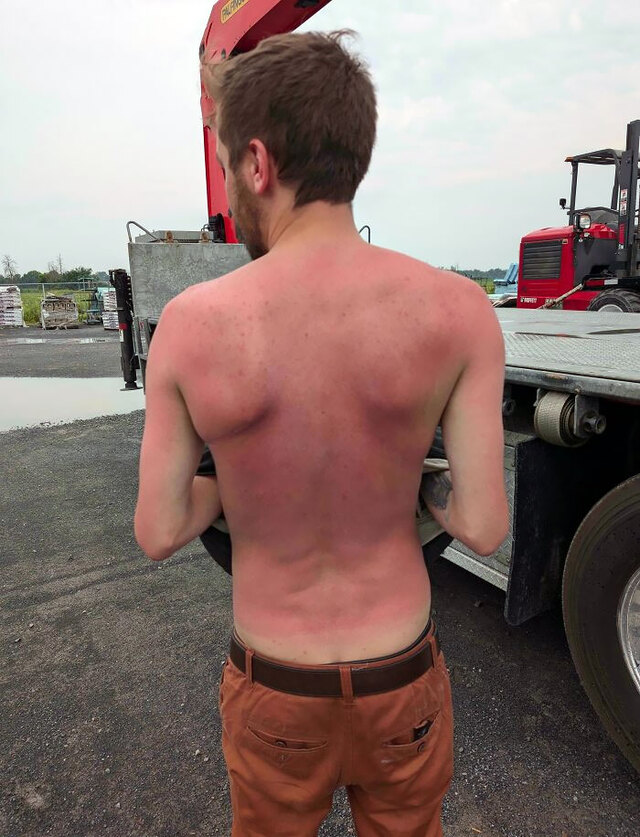 Farm Work “Base Tan” That Ended in Disaster