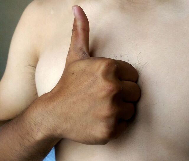 Husband’s Summer Tan Looks Like a Stranger’s Hand
