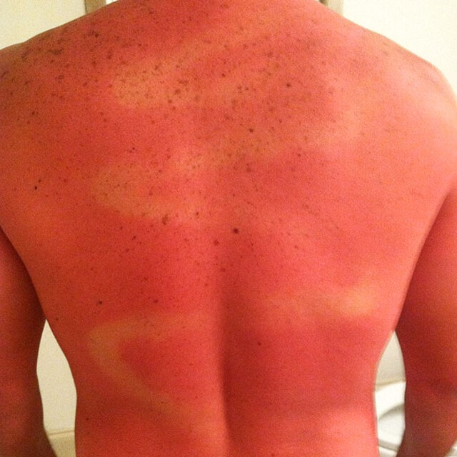 Missed Spots Creating a Strawberry Look