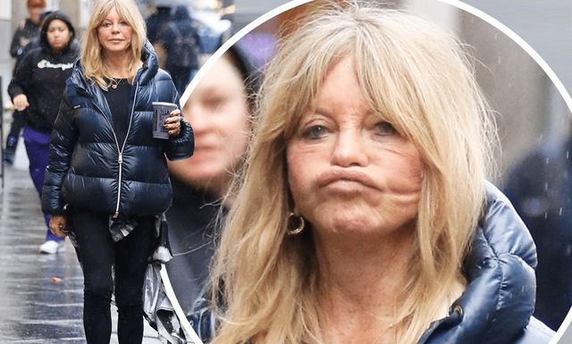 Recent candid photos ignited online buzz—some speculated about cosmetic work, while others defended her right to age her way.