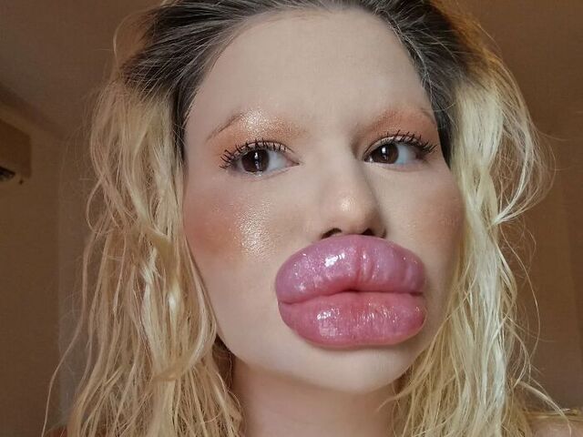 Through all the scrutiny and challenges, Andrea maintains a clear message: beauty is deeply personal, and judgment should be reserved