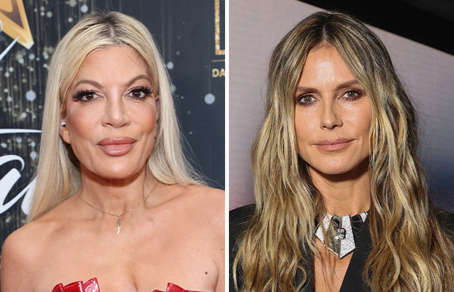 Tori Spelling’s openness about surgery stands opposite to Heidi Klum’s fear of the surgeon’s chair