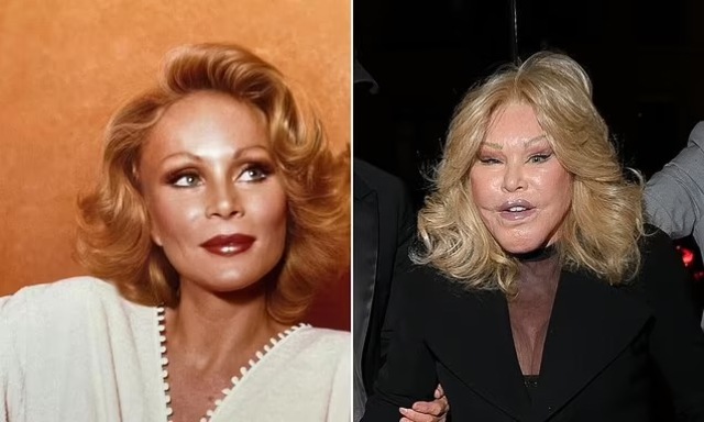 Jocelyn Wildenstein: The Extreme Side of Plastic Surgery