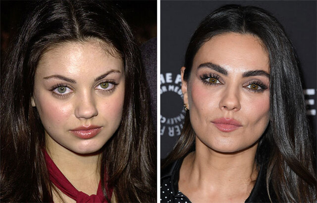 Mila Kunis: Aging Gracefully or Cosmetic Surgery?