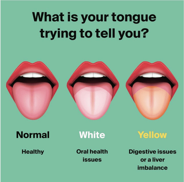 A Bright Red Tongue: When Color Speaks Volumes