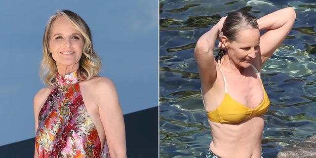 Hunt’s unretouched look serves as a reminder that real beauty lies in authenticity