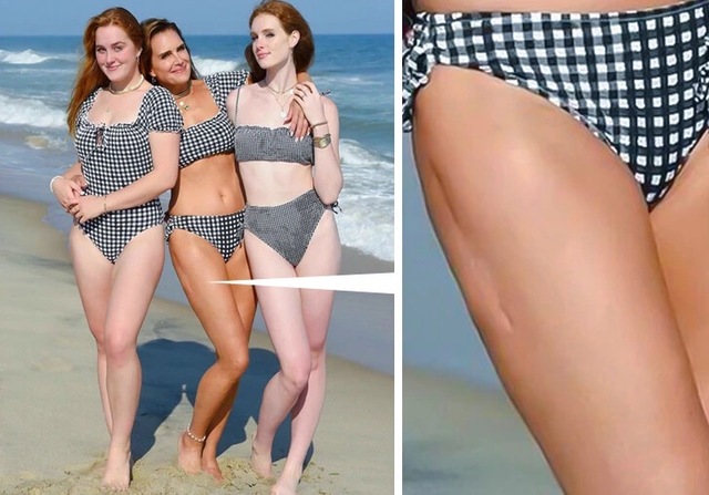 Rather than hide it, Brooke wore the scar proudly, showcasing her strength in the face of adversity.