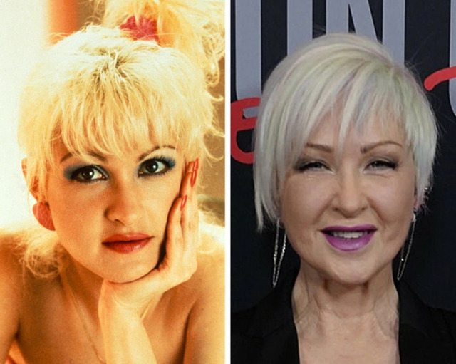 Cyndi Lauper — The Fearless Spirit of Pop