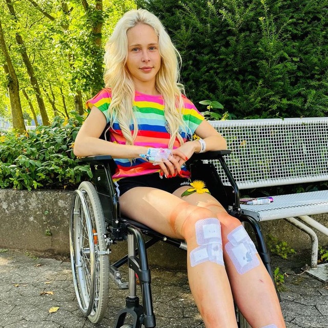 Theresia now finds herself longing for the day surgeons can remove the metal rods from her legs.