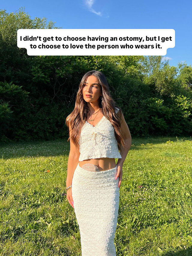 By sharing her own story, Sara has also inspired countless others to speak out about their experiences and to embrace their own bodies, regardless of the medical challenges they fac