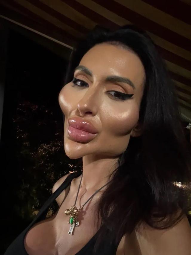 In her rare pre-surgery photos, we see a woman with soft, natural features—the kind of look many would consider classically beautiful.