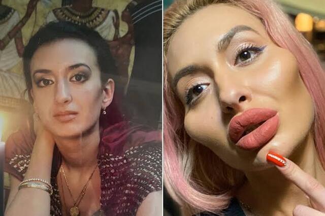 She is fully aware of the risks involved in self-injection, from infection to more severe complications, yet her commitment remains unshaken.