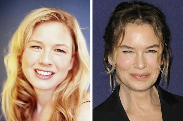 Renée Zellweger sparked a global conversation about the immense pressure on actresses to remain visually frozen in time.