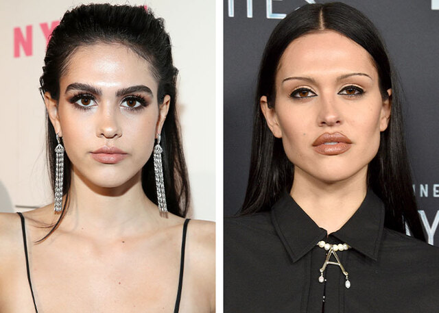 Amelia Gray Hamlin sparked intense debate over "buccal fat removal" after appearing with a much sharper jawline.