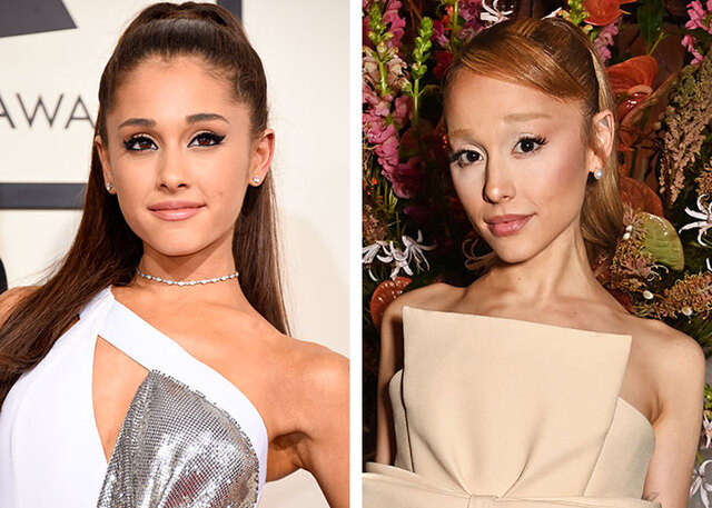 Ariana Grande revealed she stopped using Botox and fillers years ago to embrace her natural aging process.
