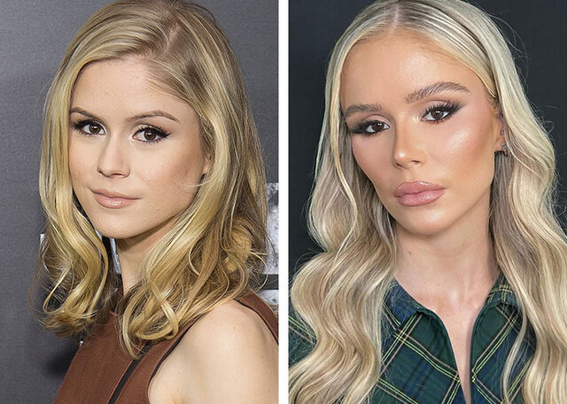 Erin Moriarty left social media after being "bullied" by false claims of radical facial reconstruction.